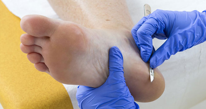 Clínica de enfermedades del pie